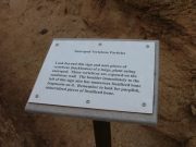 vertebrae_sign